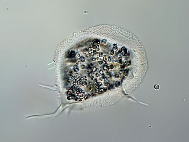 Leben im Teich Cochliopodium bilimbosum (Rhizopoda), Protista